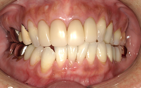After image