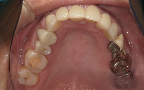 After image