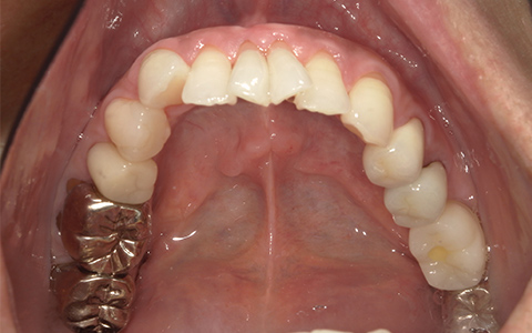 After image