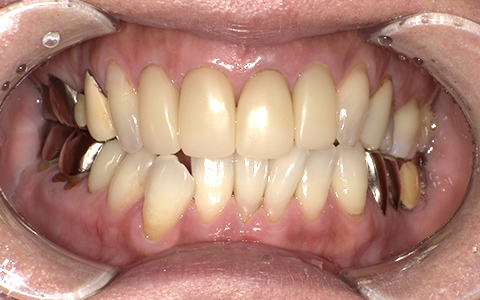 Before image