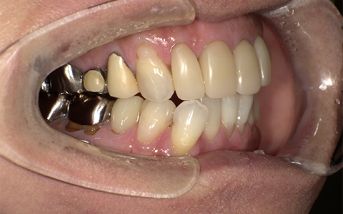 Before image