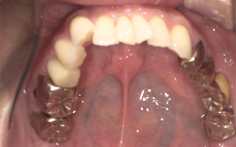 Before image