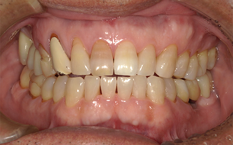 After image
