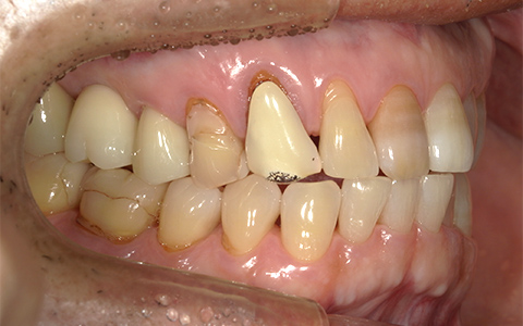 After image