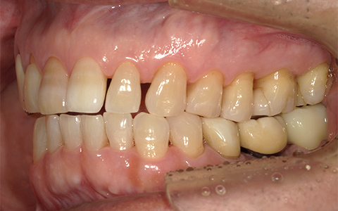 After image