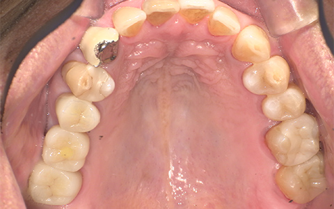 After image