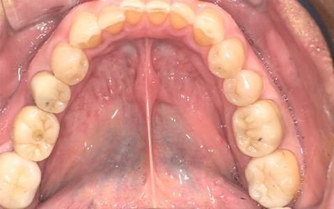 After image