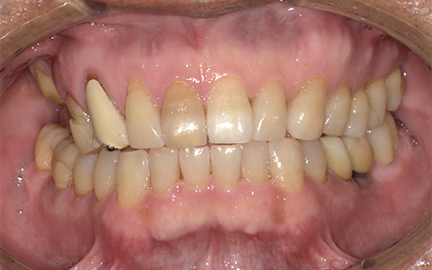 Before image