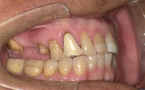 Before image