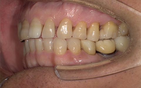 Before image