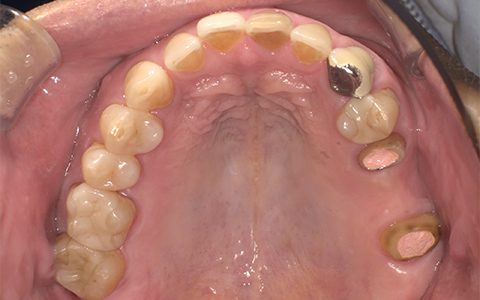 Before image