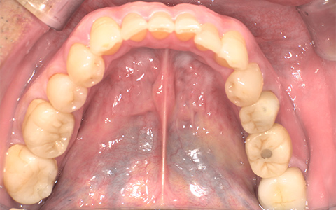 Before image