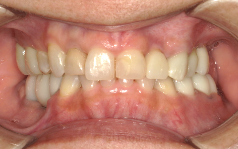 After image