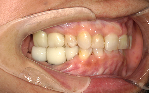 After image