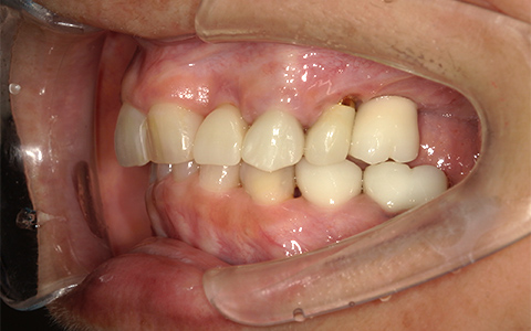 After image