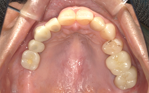 After image