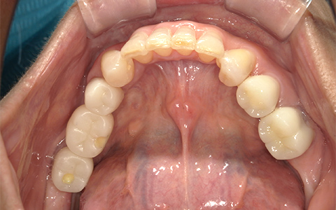After image