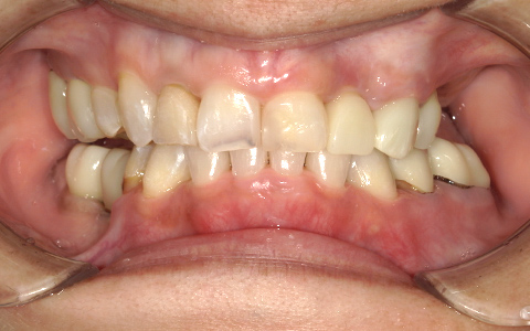 Before image