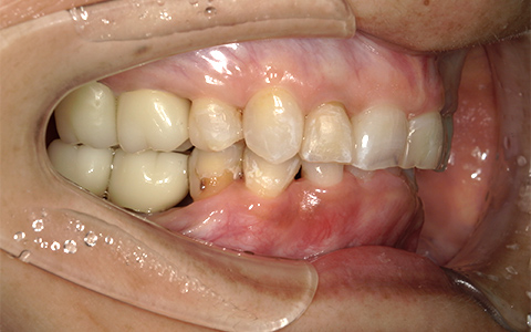 Before image