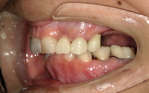 Before image
