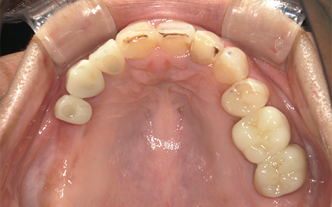 Before image