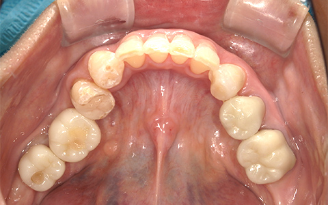 Before image