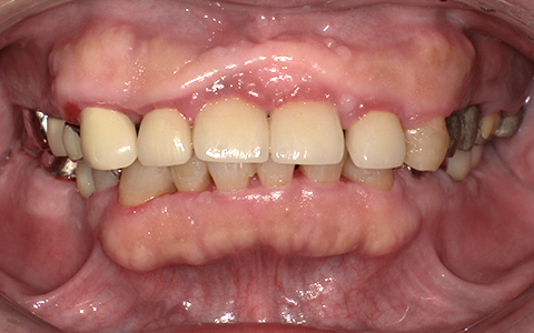 After image