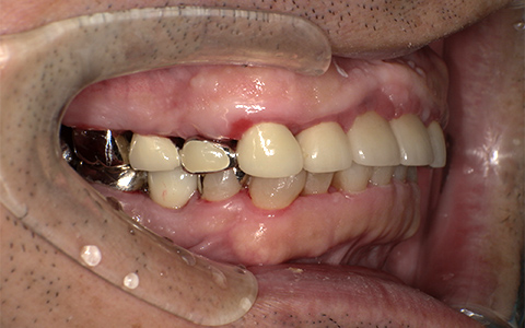 After image