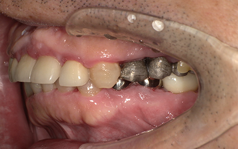 After image