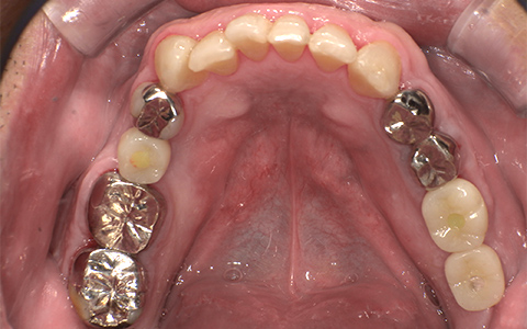 After image