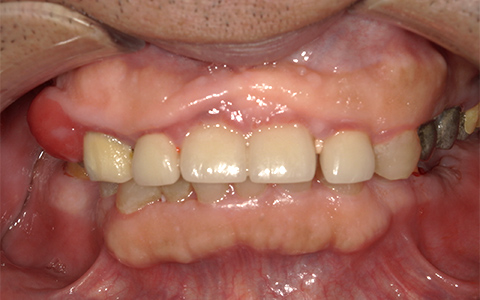 Before image