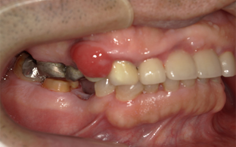 Before image