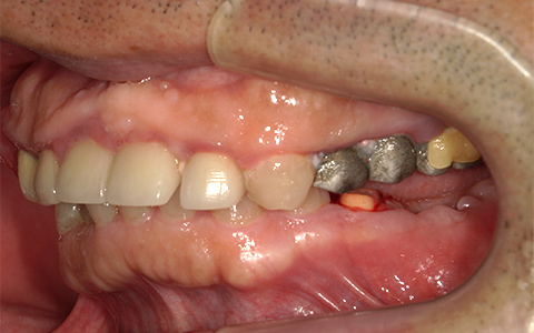 Before image