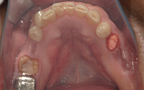 Before image