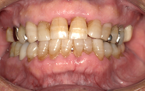 After image