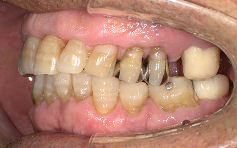 After image