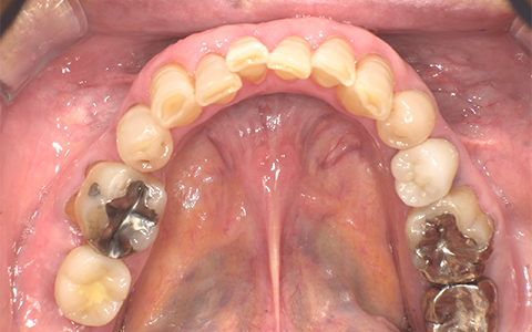 After image