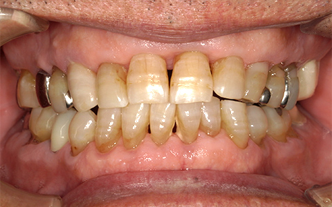 Before image