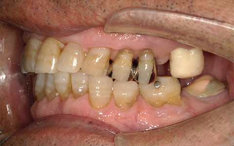 Before image