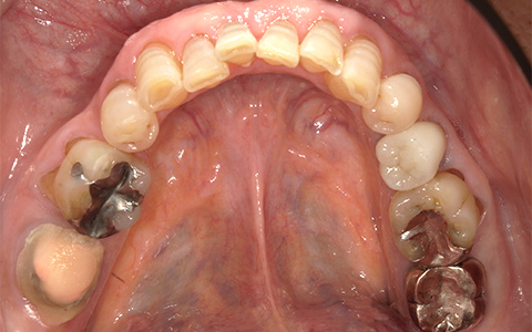 Before image