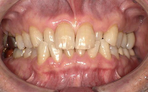After image