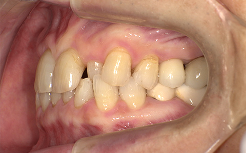 After image