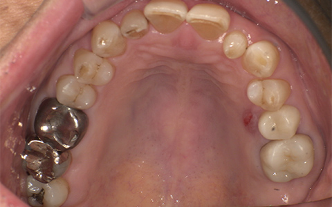 After image