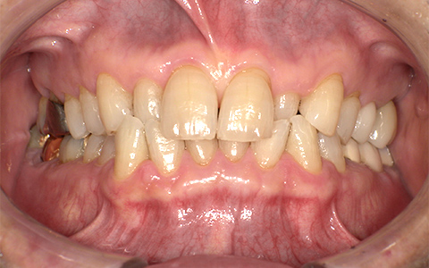 Before image