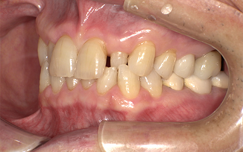 Before image