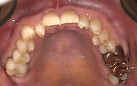 Before image