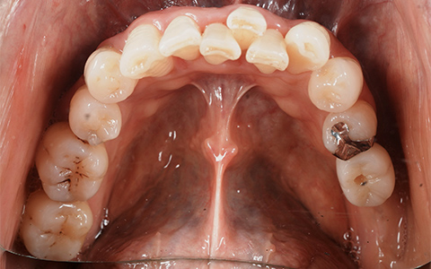 After image