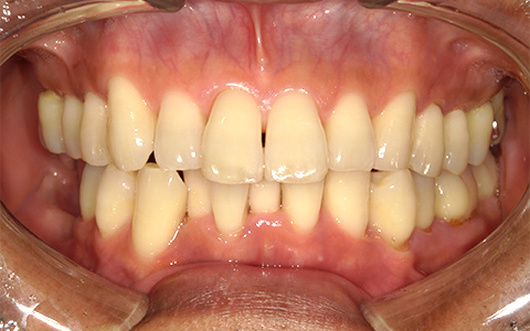 Before image