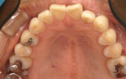 Before image