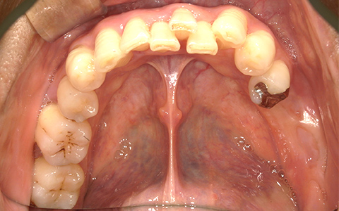 Before image